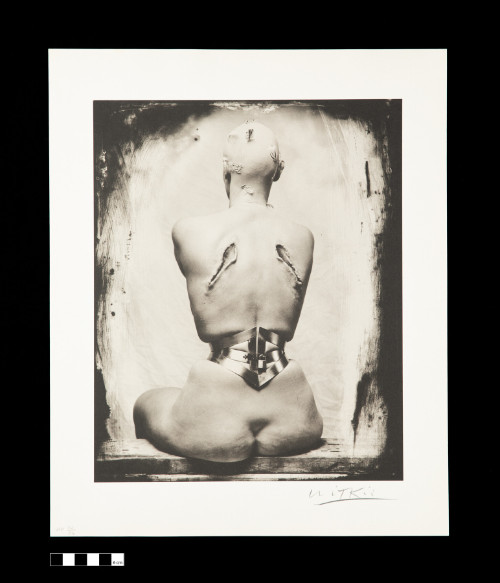 Black and white photograph of the back of seated nude figure, wearing a tight and deforming corset on their waist, scared wounds on her shoulder blades and on their shaved head.